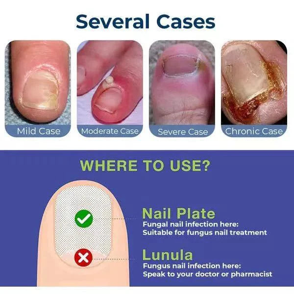 After using relief oil